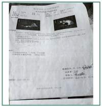 大国医者 国医名师 优秀中医传承人——杨宗仙